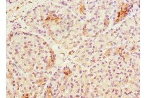 Immunohistochemistry of paraffin-embedded human pancreatic tissue using ABIN7171839 at dilution of 1:100 (ASPSCR1 anticorps  (AA 284-553))