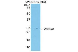 Detection of Recombinant AchE, Human using Polyclonal Antibody to Acetylcholinesterase (ACHE) (Acetylcholinesterase anticorps  (AA 377-574))