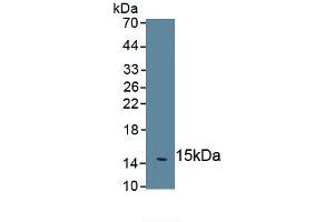Detection of Recombinant IL5, Human using Monoclonal Antibody to Interleukin 5 (IL5) (IL-5 anticorps  (AA 20-134))