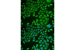 Immunofluorescence analysis of U2OS cells using PNLIP antibody . (PNLIP anticorps  (AA 166-465))