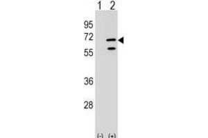 Western Blotting (WB) image for anti-Polymerase (RNA) III (DNA Directed) Polypeptide C (62kD) (POLR3C) antibody (ABIN2999296) (POLR3C anticorps)