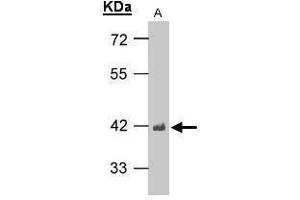 WB Image Sample(30 μg of whole cell lysate) A:H1299 10% SDS PAGE antibody diluted at 1:1000 (TARDBP anticorps)