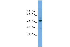 B4GALT2 antibody used at 1 ug/ml to detect target protein.
