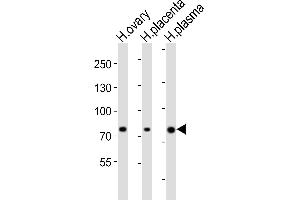 Western blot analysis of lysates from human ovary, human placenta, human plasma tissue lysate (from left to right), using ITGB8 Antibody (Center) (ABIN6244113 and ABIN6577824). (ITGB8 anticorps  (AA 197-231))
