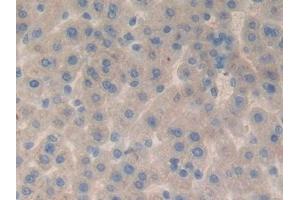 Detection of FBLN1 in Rat Liver Tissue using Polyclonal Antibody to Fibulin 1 (FBLN1)