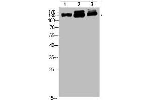 Western blot analysis of 823 293T-UV HELA Cell Lysate, antibody was diluted at 1:1000 (NFAT5 anticorps  (AA 1268-1341))