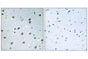 Immunohistochemistry analysis of paraffin-embedded human brain tissue using KLHL29 antibody. (KLHL29 anticorps)