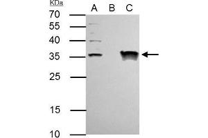 IP Image TFIIE beta antibody immunoprecipitates TFIIE beta protein in IP experiments. (GTF2E2 anticorps)