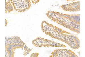 ABIN7094222 and ABIN7098269 at 1/100 staining Mouse colon tissue by IHC-P.