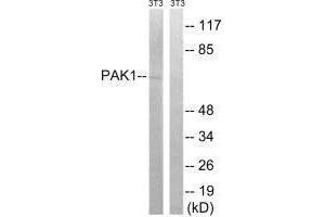 Western blot analysis of extracts from 3T3 cells, treated with UV (15 mins), using PAK1 (Ab-204) antibody. (PAK1 anticorps  (Ser204))