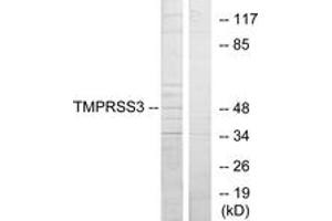Western blot analysis of extracts from HuvEc cells, using TMPRSS3 Antibody. (TMPRSS3 anticorps  (AA 405-454))