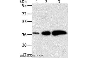 Western blot analysis of Human liver cancer and breast infiltrative duct tissue, human fetal brain tissue, using AKR1C1 Polyclonal Antibody at dilution of 1:500 (AKR1C1 anticorps)