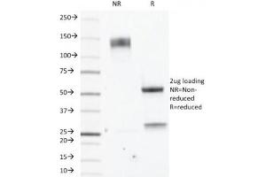 SDS-PAGE Analysis of Purified, BSA-Free Estrogen Receptor beta Antibody (clone ERb455). (ESR2 anticorps  (C-Term))