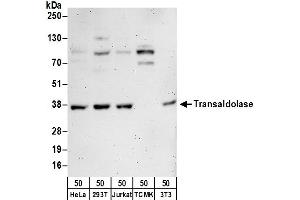 Western Blotting (WB) image for anti-Transaldolase 1 (TALDO1) (AA 200-250) antibody (ABIN7450840)