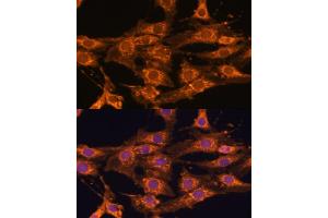 Immunofluorescence analysis of C6 cells using UBQLNL antibody (ABIN7271125) at dilution of 1:100. (UBQLNL anticorps  (AA 176-475))