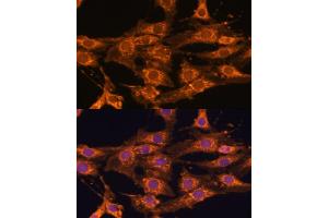 Immunofluorescence analysis of C6 cells using UBQLNL antibody (ABIN7271125) at dilution of 1:100.