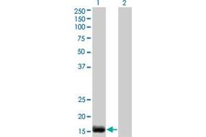 Western Blot analysis of EDN2 expression in transfected 293T cell line by EDN2 monoclonal antibody (M01), clone 3B4-1C5. (Endothelin 2 anticorps  (AA 1-178))