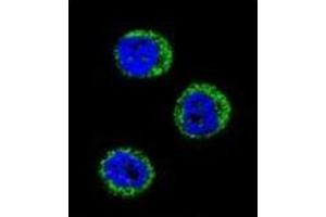 Confocal immunofluorescent analysis of Haptoglobin Antibody (Center) Cat.