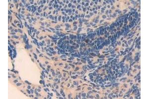 Detection of MYL3 in Mouse Ovary Tissue using Polyclonal Antibody to Myosin Light Chain 3, Alkali, Ventricular, Slow Skeletal (MYL3) (MYL3/CMLC1 anticorps  (AA 8-199))