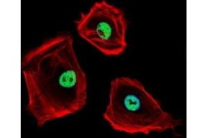 Fluorescent confocal image of SK-BR-3 cells stained with CTBP1 antibody.