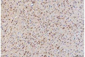 IHC analysis of LNPEP using anti-LNPEP antibody (ABIN7600279). (LNPEP anticorps  (AA 17-994))