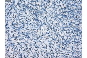 Immunohistochemical staining of paraffin-embedded colon tissue using anti-FCGR2A mouse monoclonal antibody. (FCGR2A anticorps)