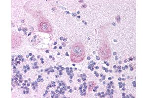 Anti-CHRNA3 antibody IHC of human brain, cerebellum.