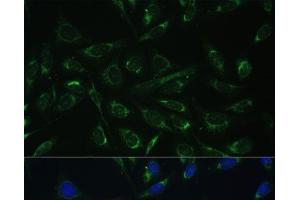 Immunofluorescence analysis of U-2 OS cells using HCCS Polyclonal Antibody at dilution of 1:100 (40x lens).
