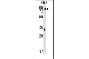 Image no. 1 for anti-TANK-Binding Kinase 1 (TBK1) (Ser172) antibody (ABIN360254) (TBK1 anticorps  (Ser172))