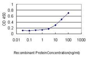 Detection limit for recombinant GST tagged SESN2 is approximately 0.