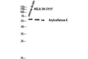 Western Blot (WB) analysis of Mouse Brain HeLa SH-SY5Y lysis using Arylsulfatase E antibody. (Arylsulfatase E anticorps  (Internal Region))