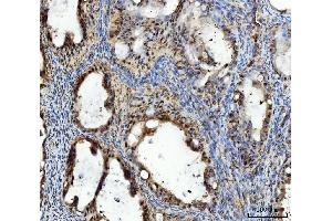 IHC analysis of TIGD1 using anti-TIGD1 antibody (ABIN7602407).