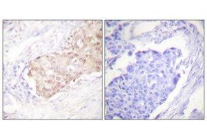 Immunohistochemistry (IHC) image for anti-Ubiquitin Protein Ligase E3 Component N-Recognin 5 (UBR5) (N-Term) antibody (ABIN1848820) (UBR5 anticorps  (N-Term))