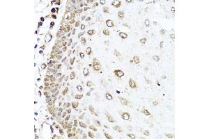 Immunohistochemistry of paraffin-embedded human esophagus using R antibody (ABIN3021523, ABIN3021524, ABIN3021525 and ABIN6215193) at dilution of 1:100 (40x lens).