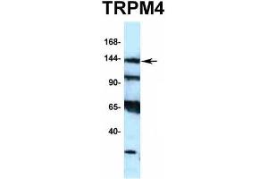 Host:  Rabbit  Target Name:  TRPM4  Sample Type:  Hela  Antibody Dilution:  1.