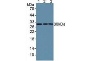 Western blot analysis of (1) Human HeLa cells, (2) Human A549 Cells and (3) Human U2OS Cells. (NNMT anticorps  (AA 1-258))
