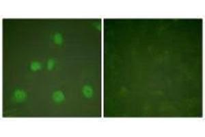 Immunofluorescence analysis of HeLa cells, treated with PMA (125 ng/mL, 30 mins), using Cullin 1 antibody.