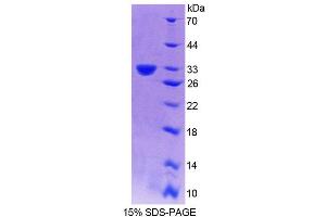 SDS-PAGE analysis of Mouse PLCd4 Protein. (PLCD4 Protéine)
