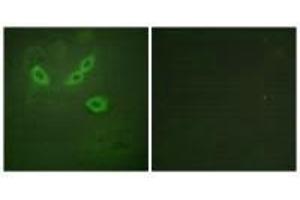 Immunofluorescence analysis of HeLa cells, using TUSC5 antibody. (TUSC5 anticorps)