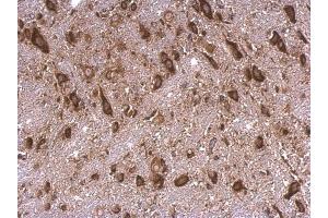 IHC-P Image RPS15 antibody detects RPS15 protein at cytosol on mouse hind brain by immunohistochemical analysis.
