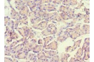 Immunohistochemistry of paraffin-embedded human pancreatic tissue using ABIN7169536 at dilution of 1:100 (ACADS anticorps  (AA 1-260))