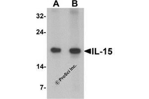 Western Blotting (WB) image for anti-Interleukin 15 (IL15) antibody (ABIN1077441) (IL-15 anticorps)