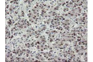 Image no. 17 for anti-Transducin-Like Enhancer of Split 1 (E(sp1) Homolog, Drosophila) (TLE1) (AA 180-460) antibody (ABIN1491049)