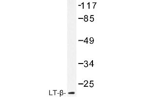 Image no. 1 for anti-Lymphotoxin-alpha (LTA) antibody (ABIN272216) (LTA anticorps)