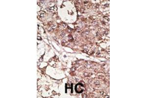 Immunohistochemistry (IHC) image for anti-CD90 (THY1) antibody (ABIN3001433) (CD90 anticorps)
