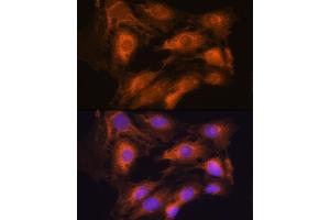 Immunofluorescence analysis of C6 cells using  Rabbit pAb (ABIN7265658) at dilution of 1:100.