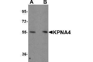 Western Blotting (WB) image for anti-Karyopherin (Importin) alpha 4 (KPNA4) (N-Term) antibody (ABIN1031431) (KPNA4 anticorps  (N-Term))