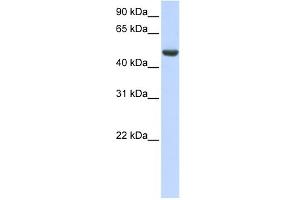 WB Suggested Anti-SPATA17 Antibody Titration: 0.