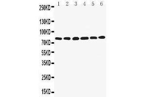 Anti-LPP antibody, Western blotting Lane 1: SMMC Cell Lysate Lane 2: HELA Cell Lysate Lane 3: SW620 Cell Lysate Lane 4: A549 Cell Lysate Lane 5: SKOV Cell Lysate Lane 6: MCF-7 Cell Lysate