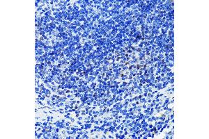 Immunohistochemistry of paraffin-embedded mouse spleen using P antibody  at dilution of 1:100 (40x lens). (PARP1 anticorps)